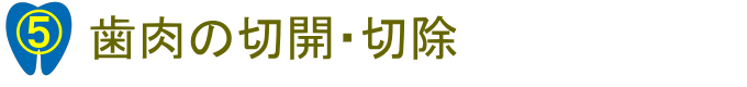 歯肉の切開・切除