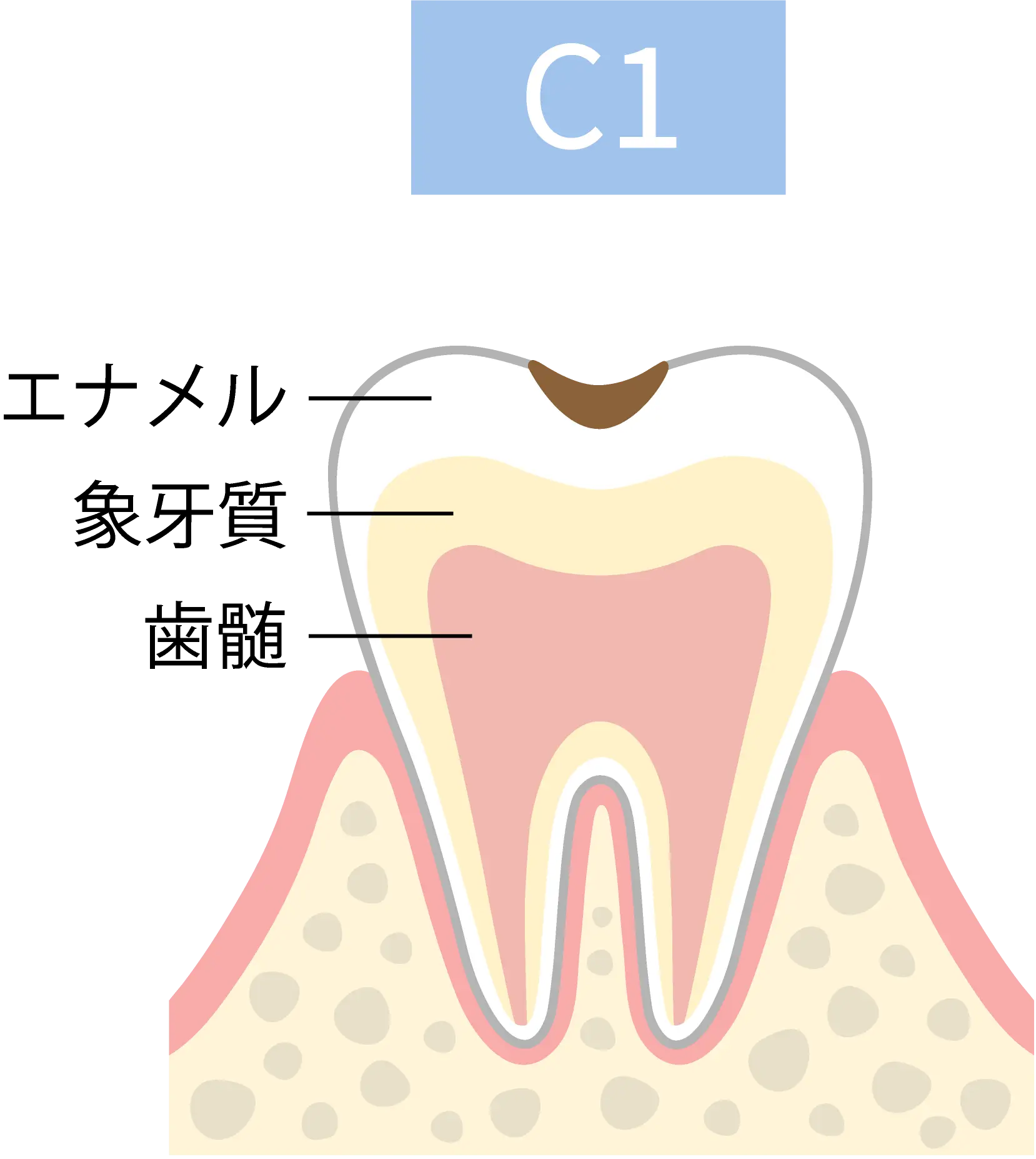 C1
