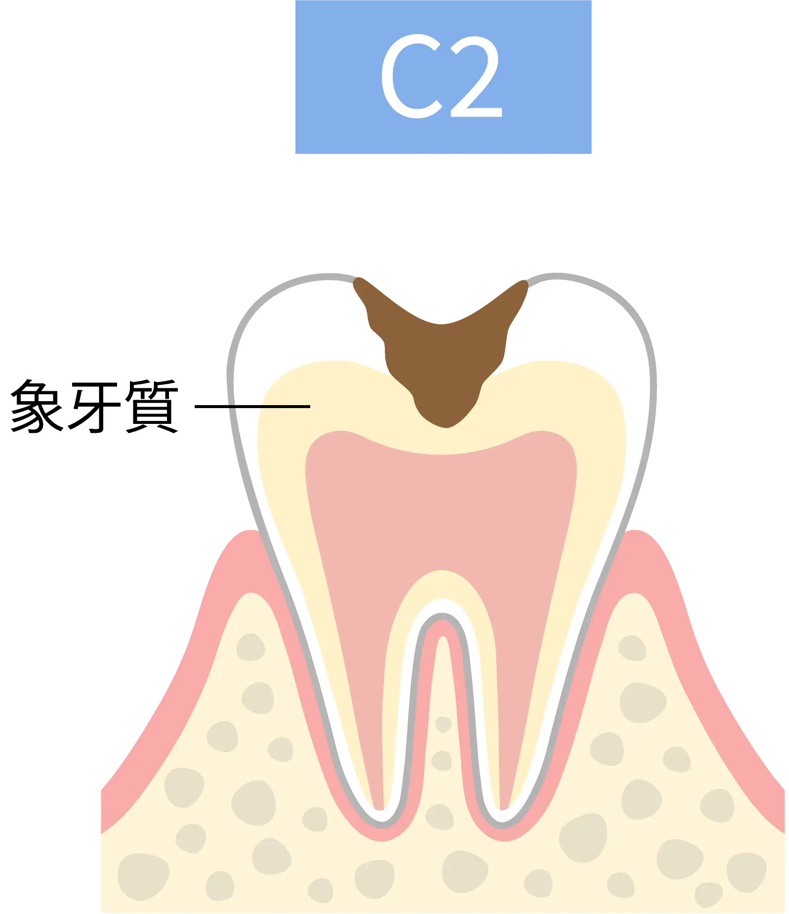 C2