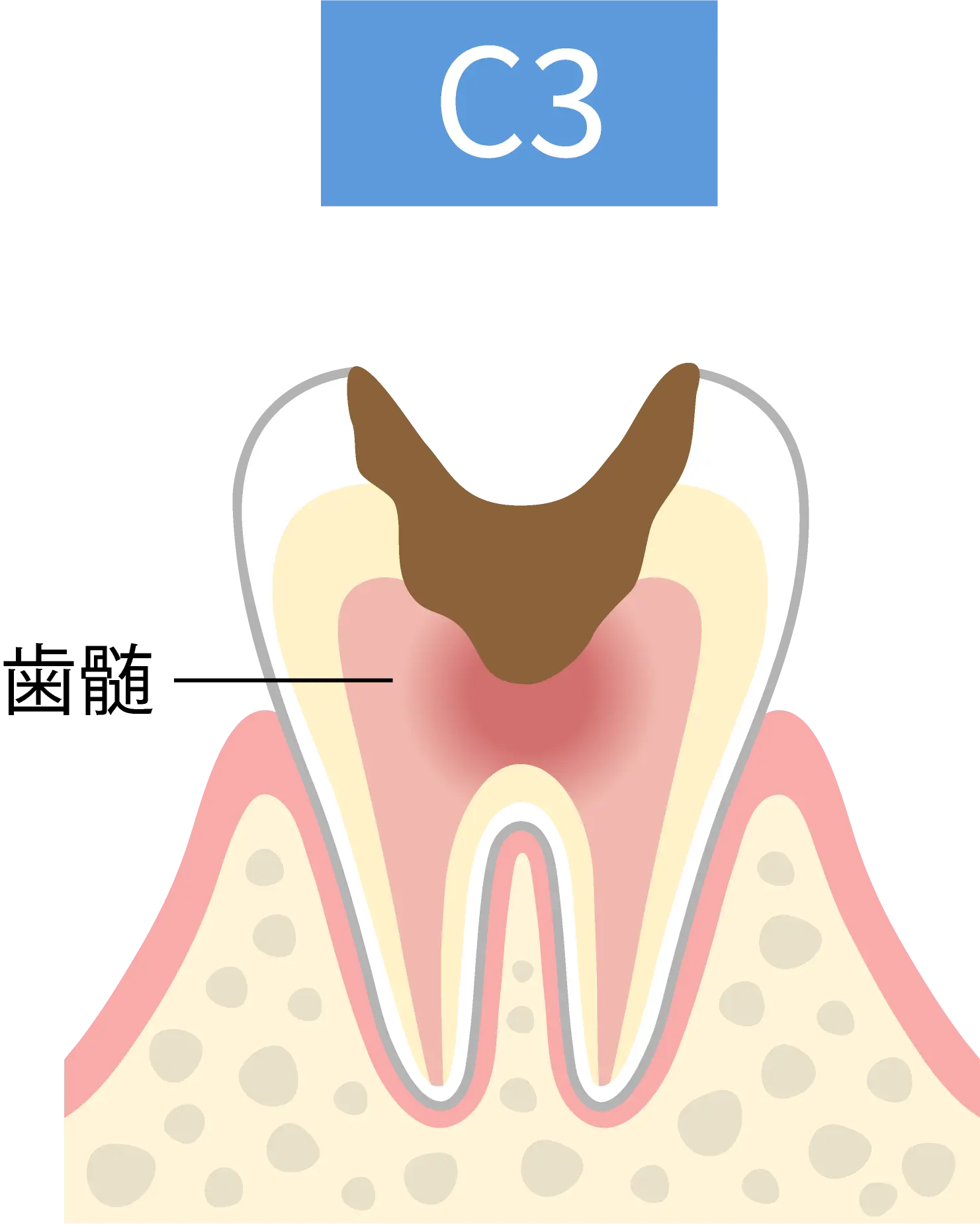 C3