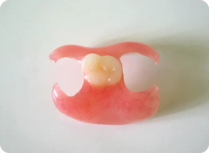 ノンクラスプデンチャー