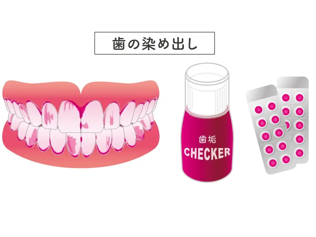 検査3　歯垢の付着